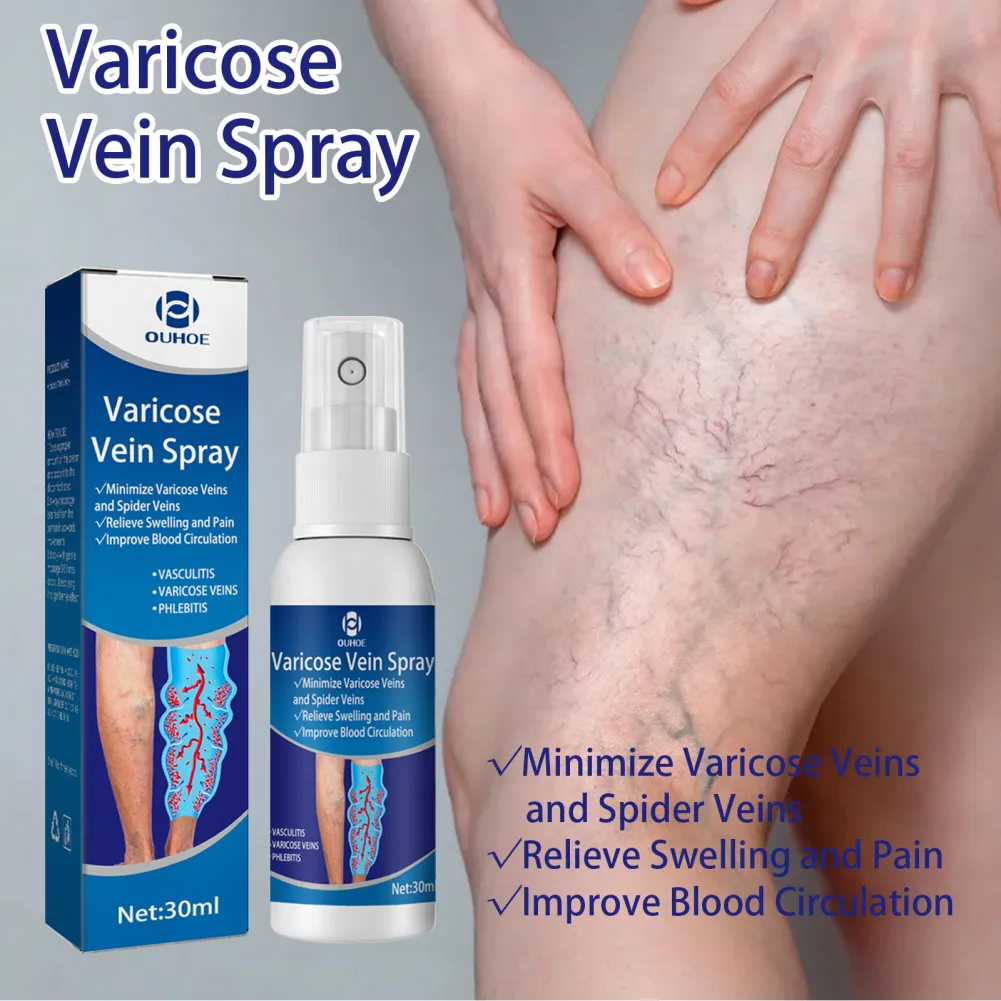 OUHOE Varicose Veins Spray