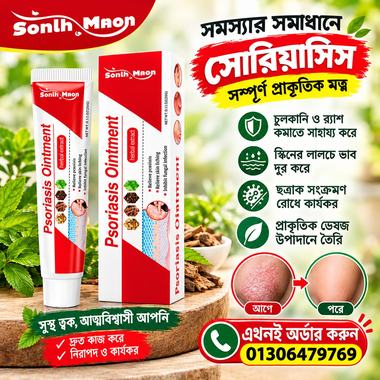 Psoriasis Ointment চুলকানি ও ত্বকের সমস্যার জন্য!